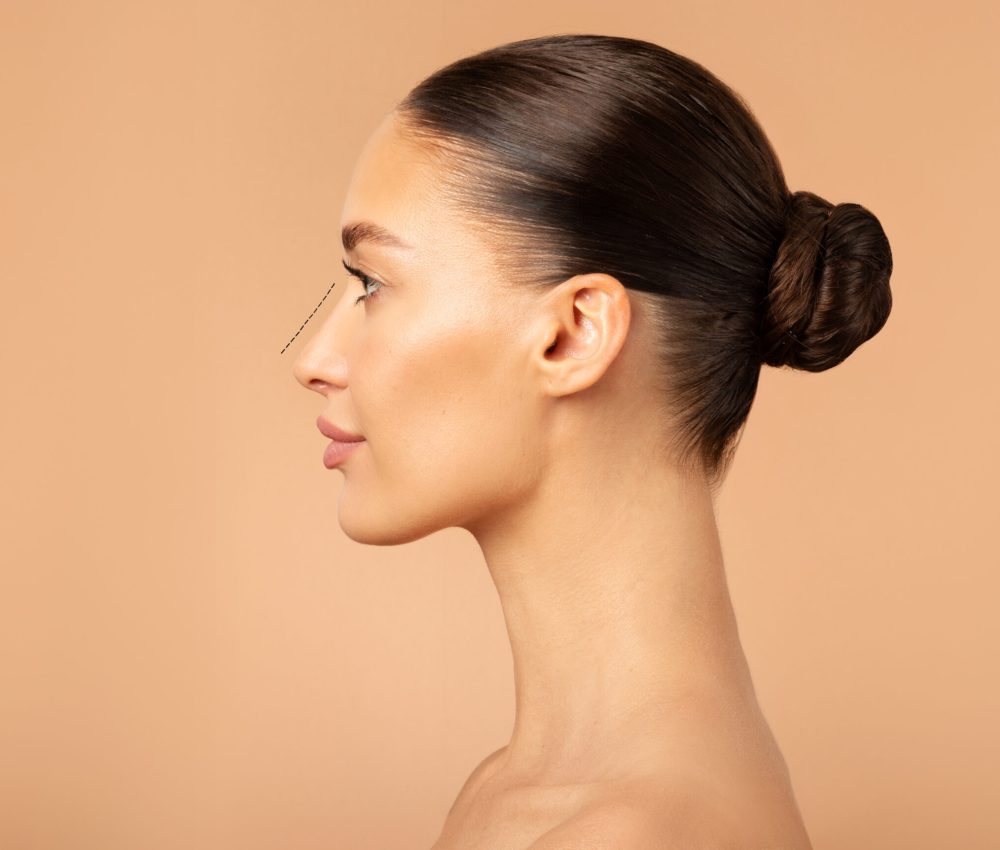 Profile side view of young woman after rhinoplasty operation with perfect nose posing on beige background